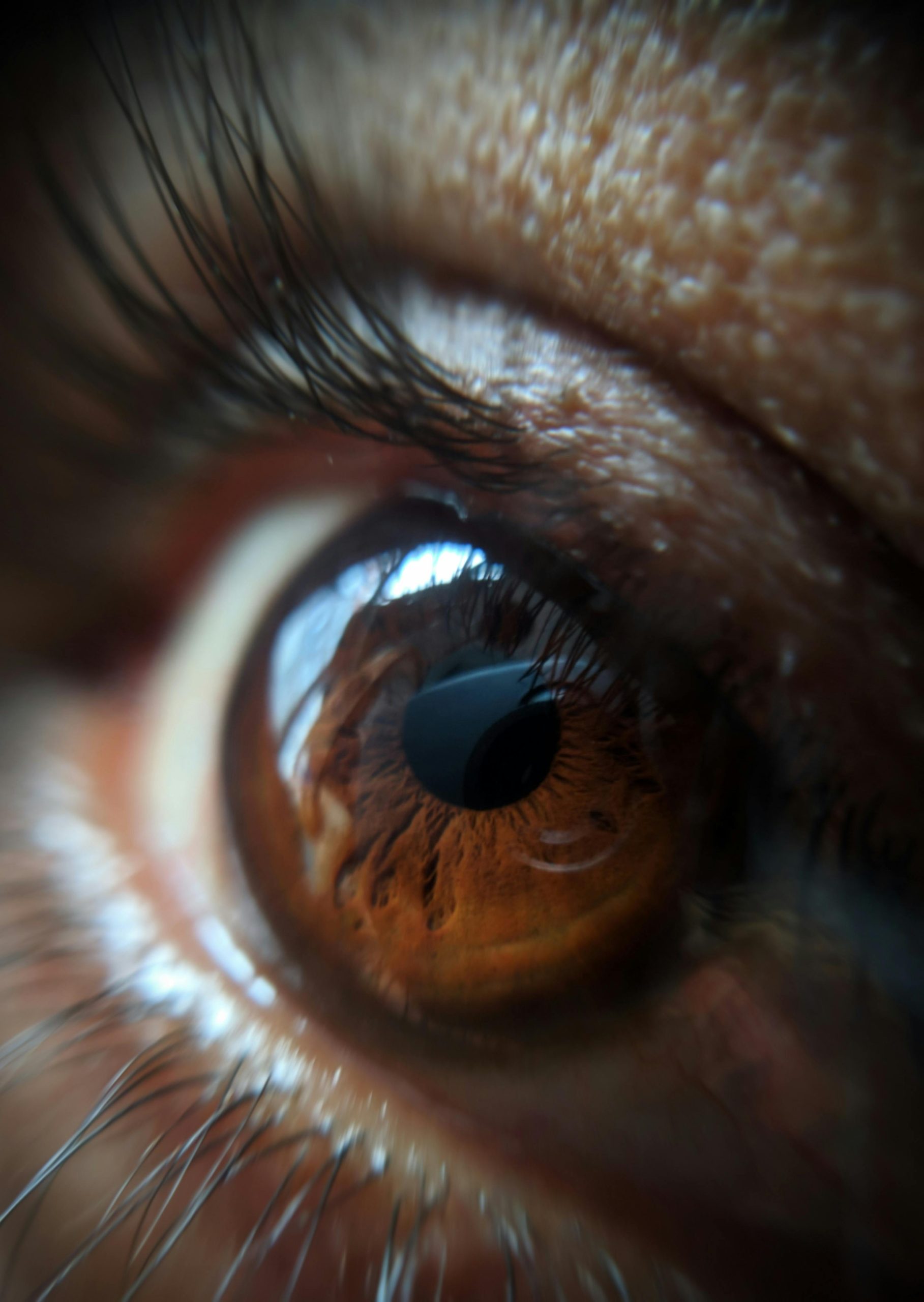 The Rise of Lasik Istanbul as a Global Eye Care Hub